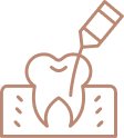 Root Canal Treatment